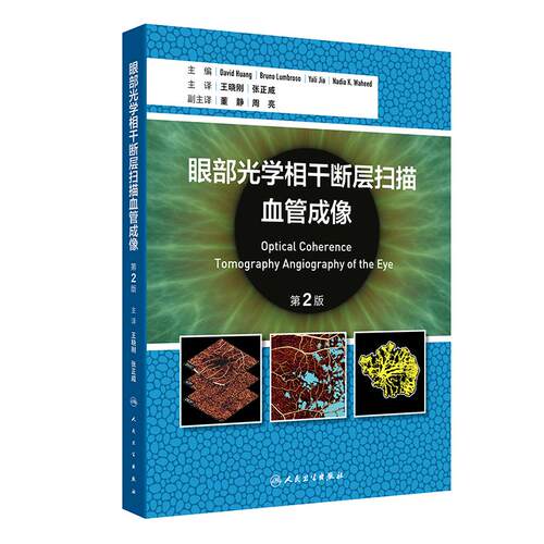 眼部光学相干断层扫描血管成像 第2版 王晓刚 张正威 主译 内容丰富贴合临床的实用性专业书籍 人民卫生出版社 9787117391023