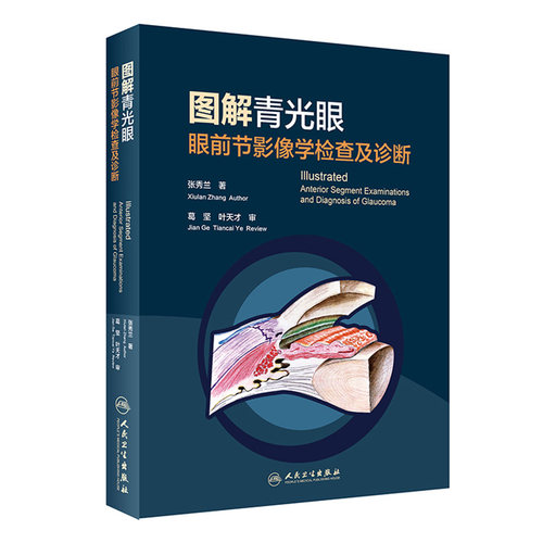 全面实用的房角镜、前节OCT、UBM诊断图谱