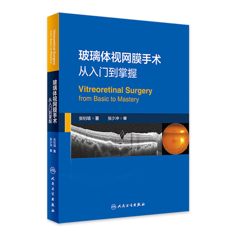 玻璃体视网膜手术从入门到掌握基本操作经验张钊填电子版孔源性视网膜脱离糖尿病病变儿童玻璃体黄斑眼底外科医师实用临床培训书