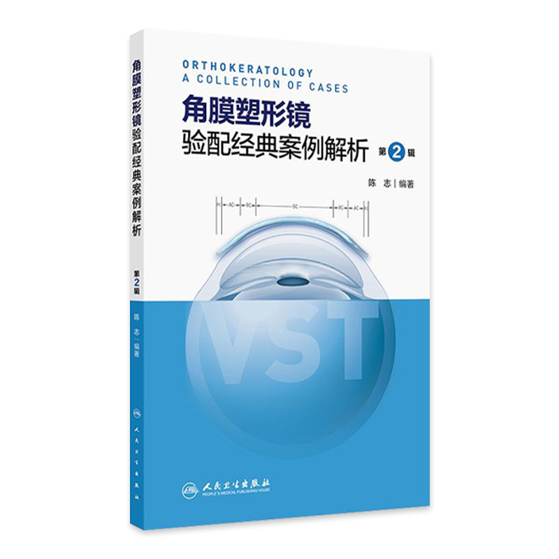 角膜塑形镜验配经典案例解析第2辑陈志配镜原则vst镜片crt近视控制技术矫正OK激光标记白内障参数识别地形图选择采集点染球面设计
