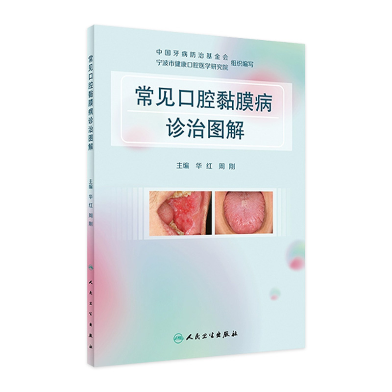 常见口腔黏膜病诊治图解 华红周刚溃疡感染疱疹唇舌斑纹类疾病激光治疗药物抗真菌护理人民卫生出版社医学口腔书籍