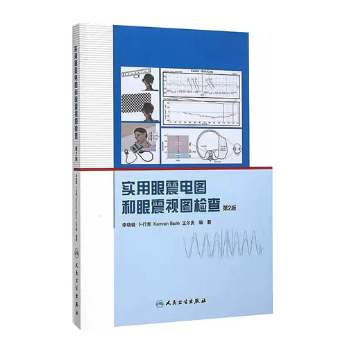 实用眼震电图和眼震视图检查