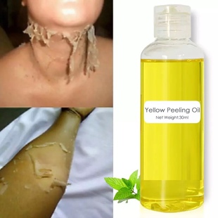 Yellow Peeling Oil Strong Lighten elbows Knees Hands Melanin