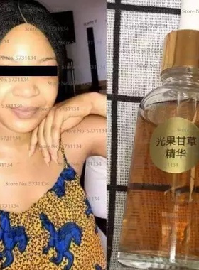 Authentic Strong Whitening Serum Dark Skin Lightening Lotion