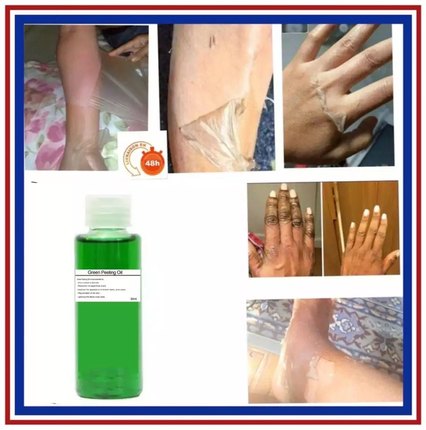 Exceptional Green Peeling Oil WHITENING LIGHTENING DARK SPOT