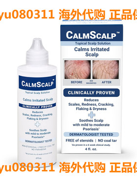 CalmScalp Topical Scalp Solution | Calms Irritated Scalp