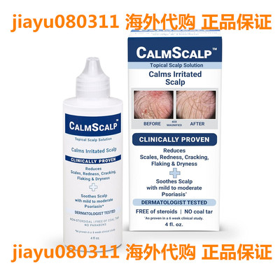 CalmScalp Topical Scalp Solution | Calms Irritated Scalp