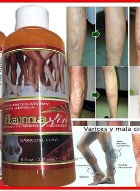 Medic Herbal Ointment Varicose Veins Vasculitis Treatment Fo