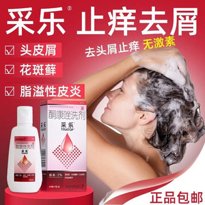 采乐酮康唑洗剂毛囊炎洗发水脂溢性皮炎酮康挫旗舰店去屑非复方膏