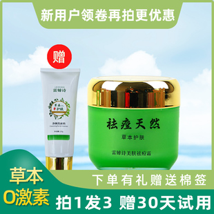 祛痘膏官方旗舰店正品青春痘男学生修复去豆豆工厂天然草本祛痘霜