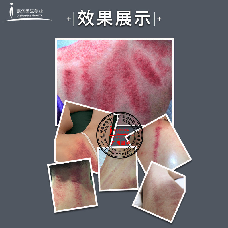 5d立体精雕仪器减爆肥脂塑形体雕仪疏通经络震动发热刮痧养生仪器