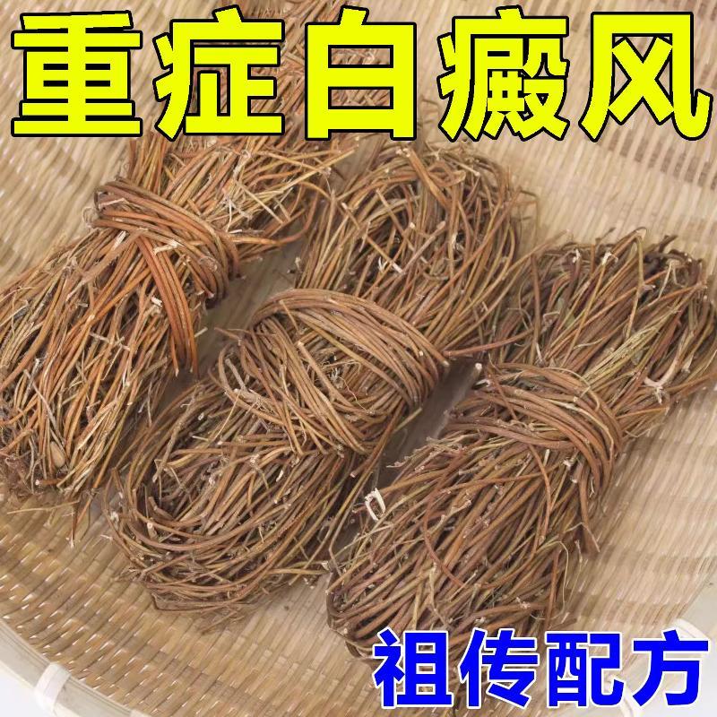 白癫药膏皮肤色素脱失外用黑色素生长补骨脂酊快速肖白斑专用药膏