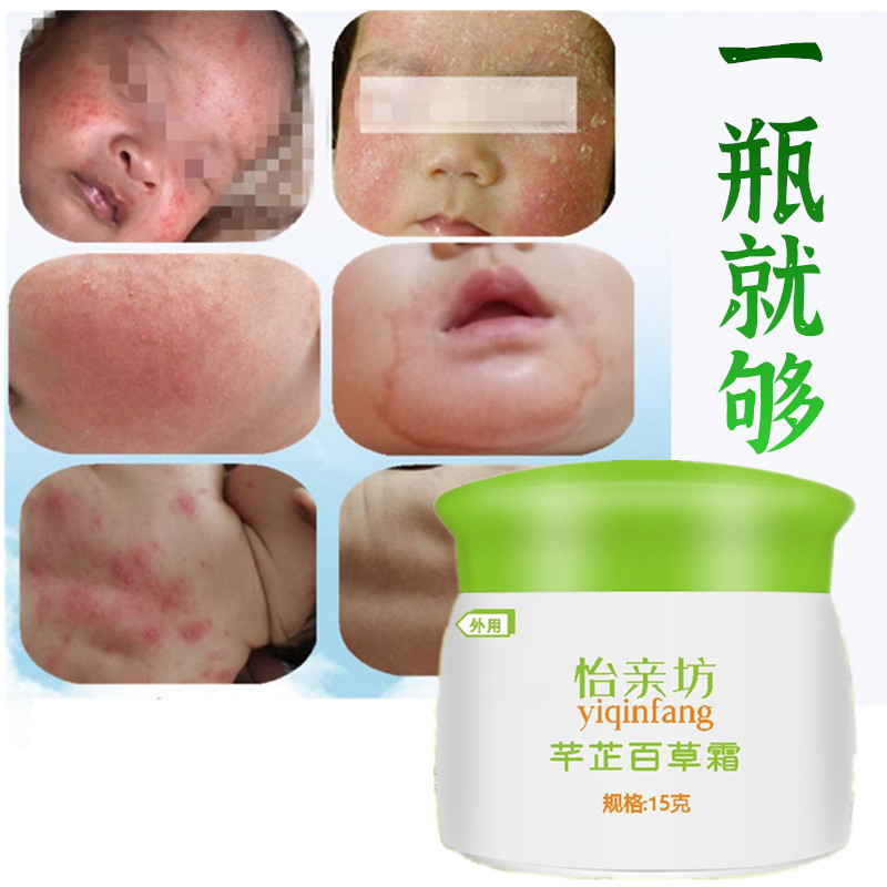 怡亲坊芊芷百草霜新生皮肤止痒膏护臀膏儿童瘙痒蚊虫叮咬热痱子