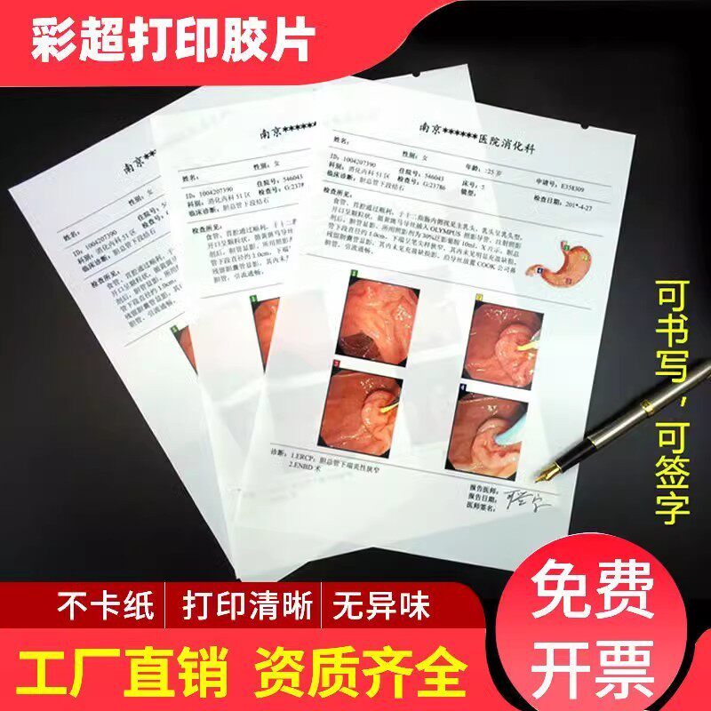 整箱1000张胶片打印半透明瓷白喷墨激光胃镜b超四维彩超打印纸