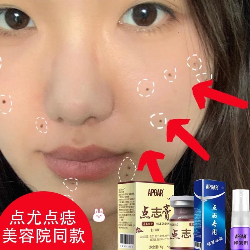 点痣膏无痕正品取痣药水脸部身上祛痦子药膏修复液去黑痣