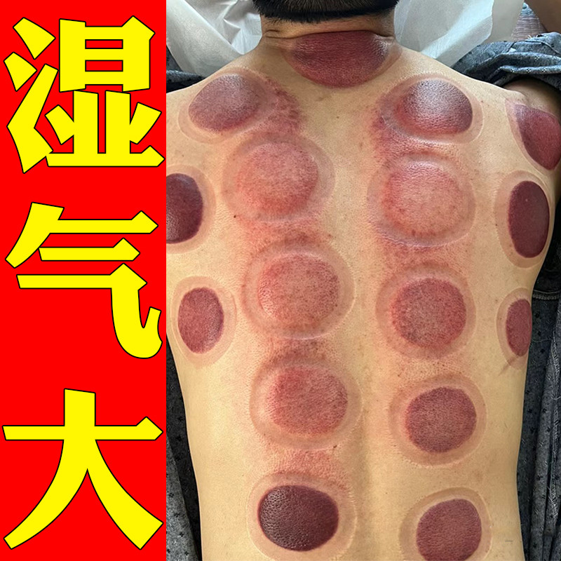 湿气重去湿气男贴肝火旺盛湿气大除口臭体寒排毒湿气太重吃什么药