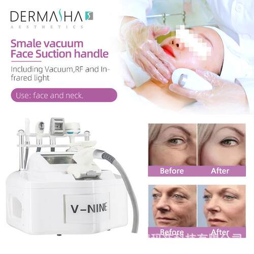 热销VacuumrfCelluliteRollingV9VelaBodyShapingMachine