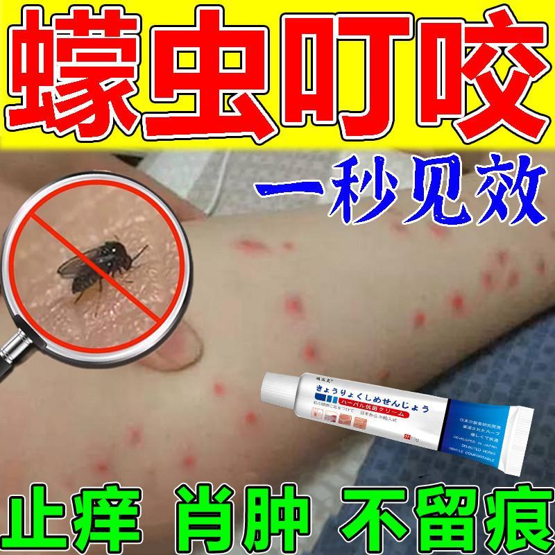 蠓虫咬伤止痒膏蚊虫叮咬止痒消红肿儿童蚊子咬蜱虫跳蚤咬消肿小咬