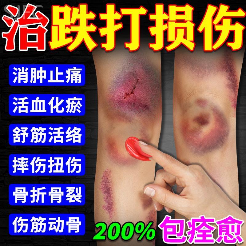 跌打损伤特效药淤青快速消除活血化瘀伤筋动骨骨折骨裂崴脚扭伤药