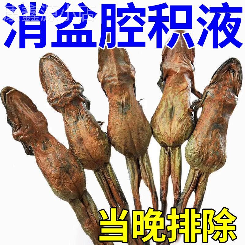 盆腔积液当天干净】盆腔积液中药贴治疗输卵- 管堵塞宫腔粘连膏G