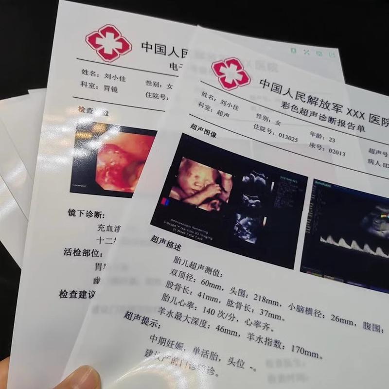 整箱1000张打印b超半透明瓷白喷墨激光胃镜胶片四维彩超打印纸