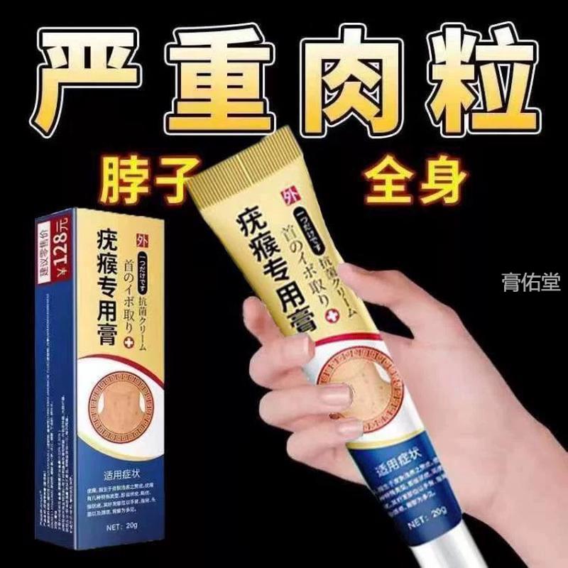 全身刺猴去除肉粒一抹去脖子上的小肉粒腋下颈部赘皮脸部特效疙瘩