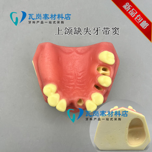 口腔种植练习模型上颌骨 上颌窦牙列缺失种植体齿科牙科模型 包邮