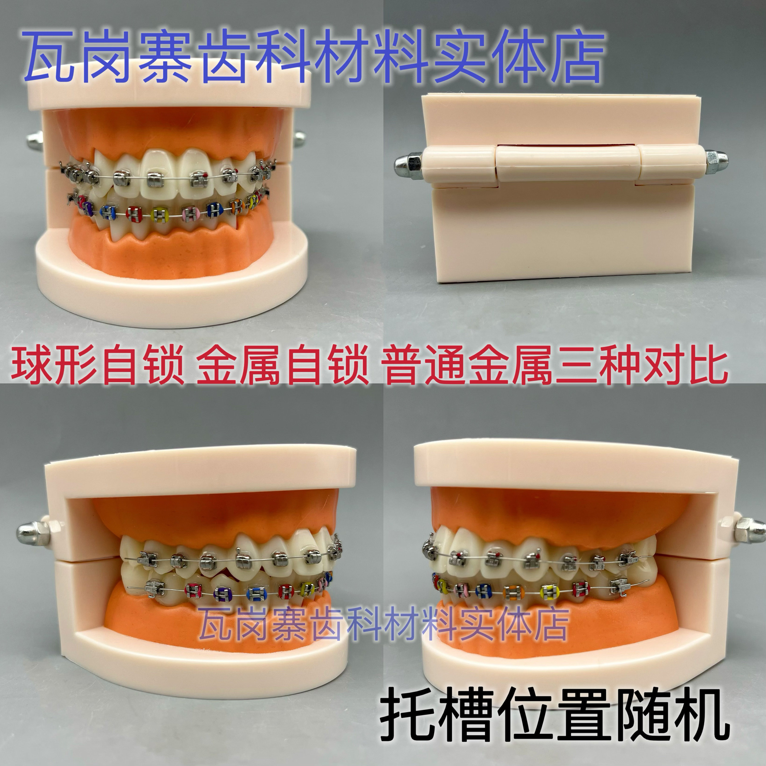 牙科 正畸模型 金属托槽 牙模 教学带托槽弓丝颊面管口腔展示模型