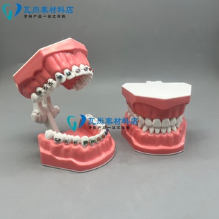 牙科口腔标准正畸模型 带弓丝结扎圈 医患沟通 讲解 示范托槽练习