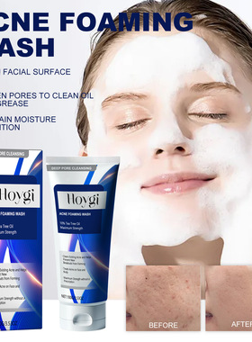 Foaming Cleanser Deep Facial Cleansing Gentle Oil Control Hy