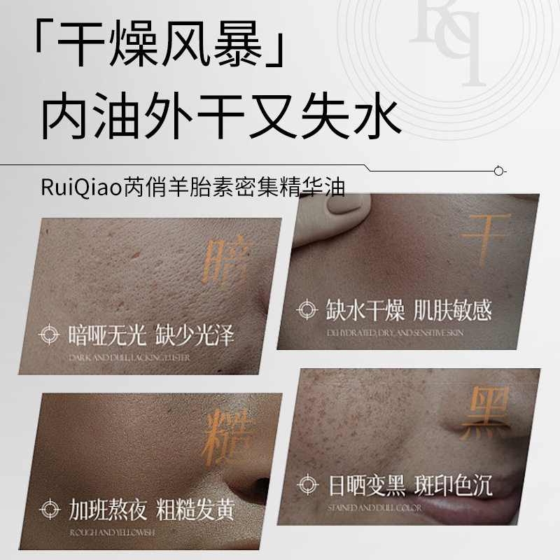芮俏羊胎素密集精华油滋润补水嫩肤精油修护抗皱面部抗皱精华油女