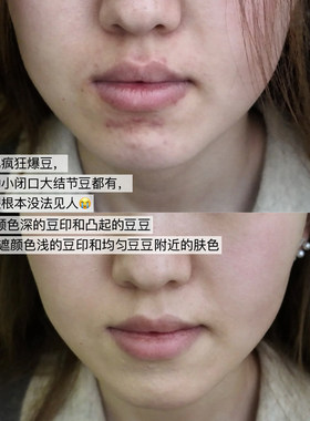 高光痘瑕液小样黑眼圈Birch遮试色提亮斑点遮Cotton印