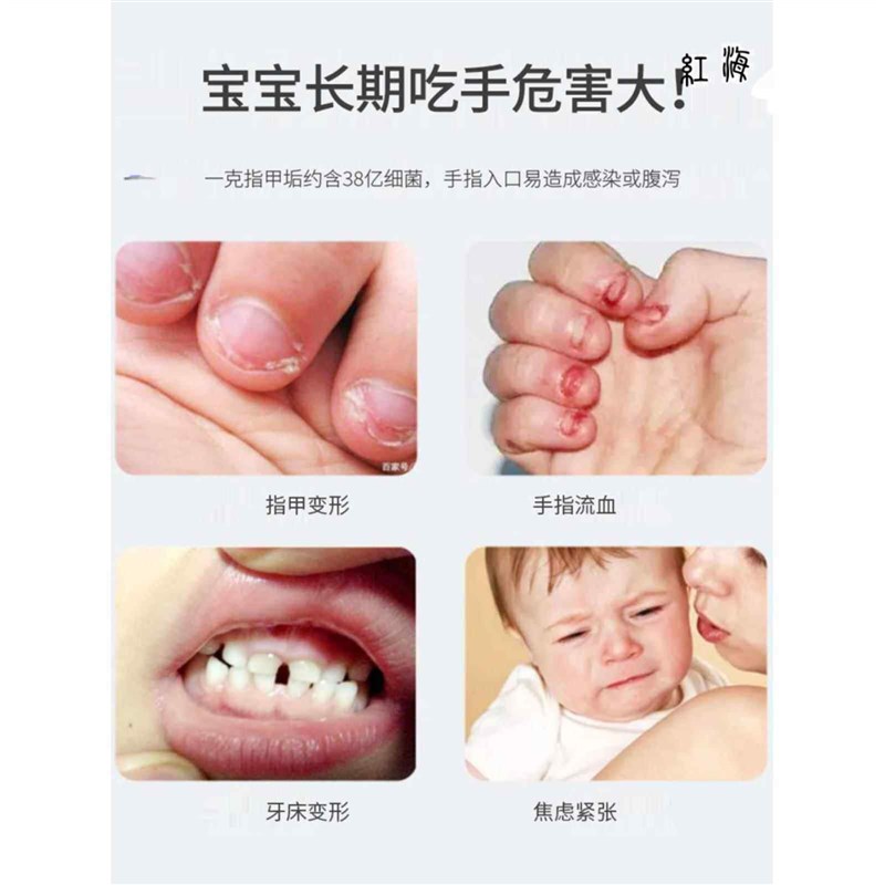 热销宝宝戒吃手手套手瘾矫正器吸咬防吃手神器大拇指儿童戒手指套