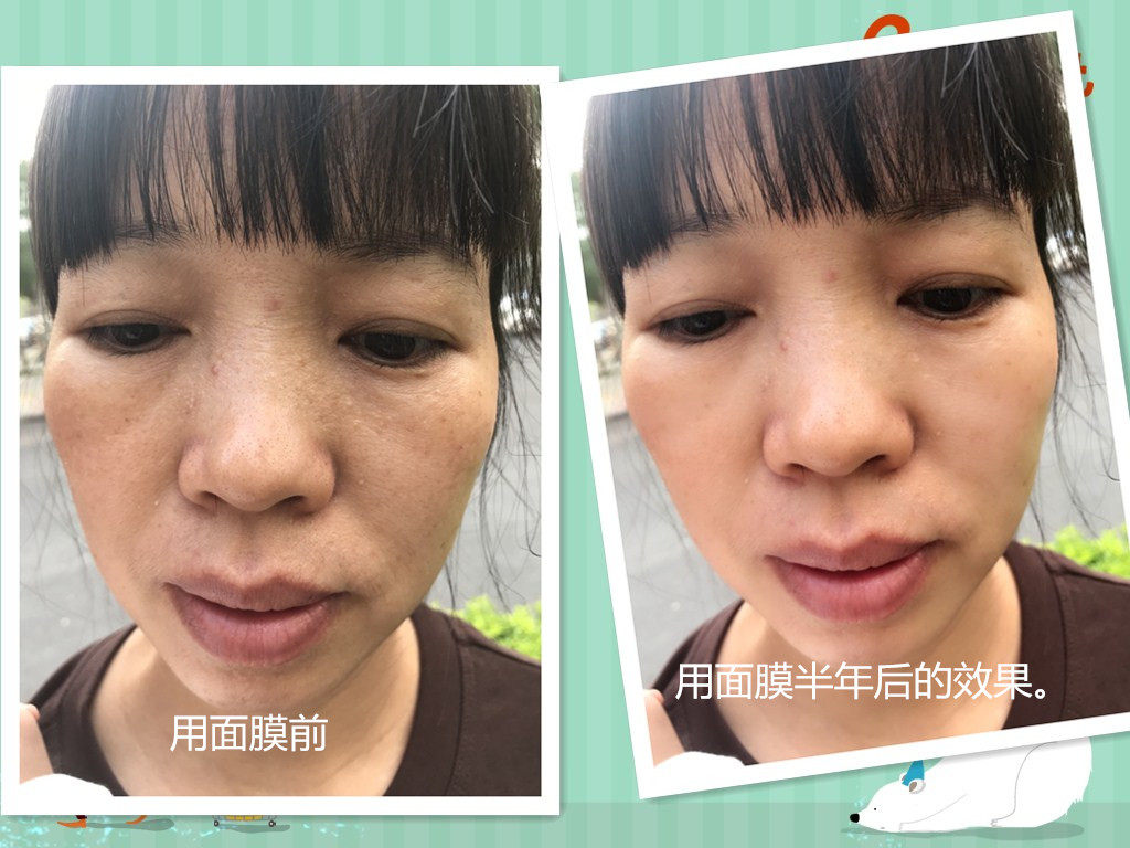 纯草药淡bān美bái皮肤调理肤色kang shuāi 老  淡zhòu wén