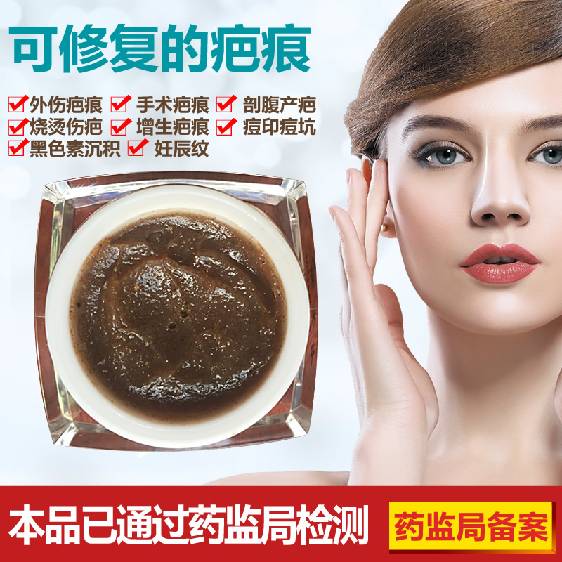 剖腹产疤痕灵修复膏擦伤摔伤去痘印痘坑烫伤烧伤增生疙瘩胸前口