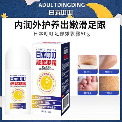 日本叮叮足部皴裂凝露膏50g手足干裂修护防皲裂长效保湿厂家批发