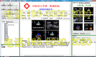 B超彩超软件昆明杰软超声软件胃肠镜耳鼻喉支气管镜宫腹腔镜软件