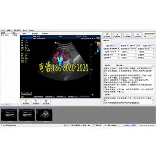 淳仁超声高清软件彩超工作站淳仁胃肠镜宫腹腔镜耳鼻喉镜加密锁