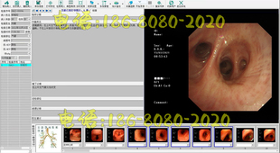 支气管镜软件高清版电子纤维支气管镜工作站软件内窥镜高清软件
