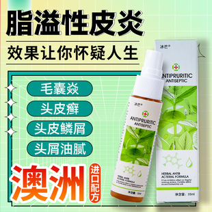 冰芒牌头癣专用溢脂性皮炎毛囊痘痘红疙瘩真菌感染头皮瘙痒藓喷剂