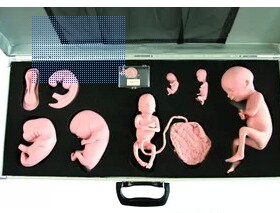 高级胚胎发育过程模型GD/FT336胎儿十月发育过程模拟人/教学培训