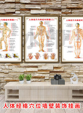 人体经穴与病症对照图广告画中医养生馆经络穴位墙壁挂画定制KT板