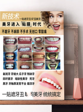德国6D纳米美牙齿贴膜时代宣传海报定制广告挂画牙科展板玻璃贴纸