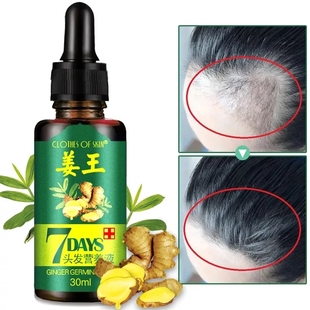 Hair Loss Treatment Ginger Growth Essence Oil老姜头发养护油