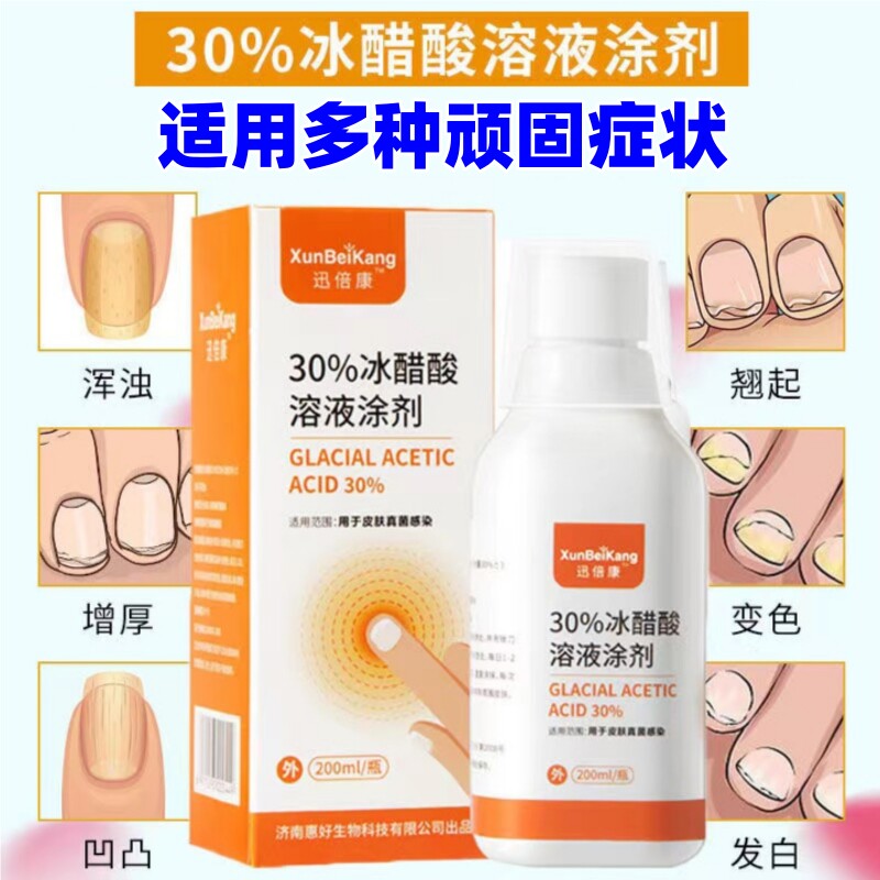 迅倍康冰醋酸30%抗菌液涂剂手指甲脚趾泡脚杀菌专外用溶液正品KW图片