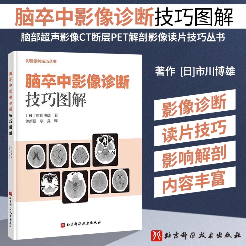 脑卒中影像诊断技巧图解脑部脑卒中影像诊断影像CT读片MRI技巧脑部超声影像CT断层PET解剖影像读片技巧丛书 9787571424657北科