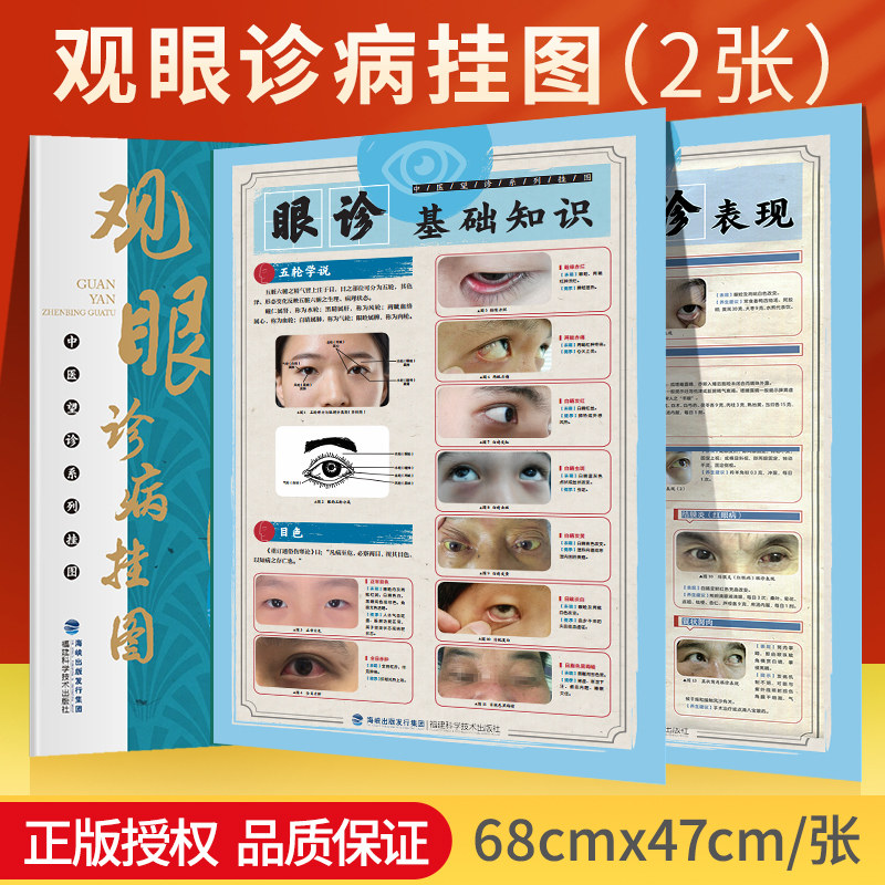 【47厘米*68厘米】2张眼诊全彩挂图 观眼诊病挂图 中医望诊系列挂图中医常见病症简单医治中医养生中医入门 书籍中医诊断学相关_虎窝淘