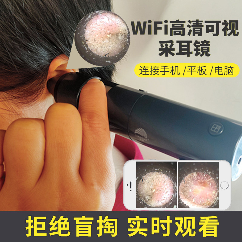 四图对比高清对焦接电脑手机 放大10倍300倍600倍 无线显微镜耳镜