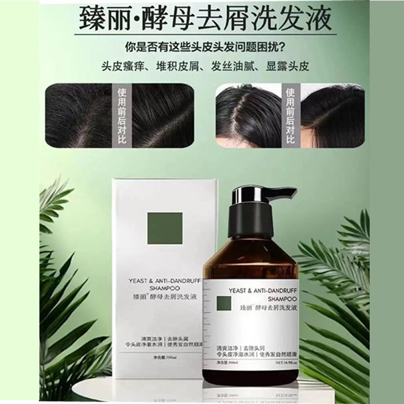 臻丽酵母去屑洗发水清爽控油