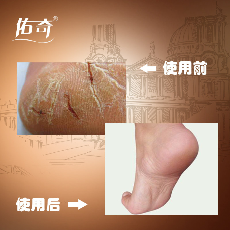 Chaussettes - collants chaussettes Crack - Ref 756371 Image 3